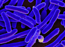 NGỘ ĐỘC THỰC PHẨM DO VI KHUẨN ESCHERICHIA COLI VÀ VI KHUẨN STAPHYLOCOCCUS AUREUS
